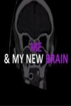 Me & My New Brain